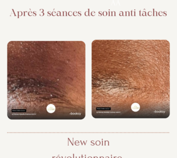 anti tache
