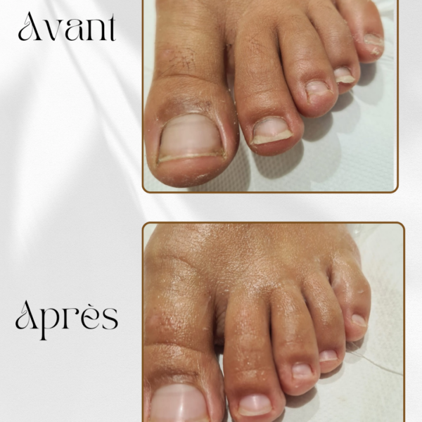 soin des pieds