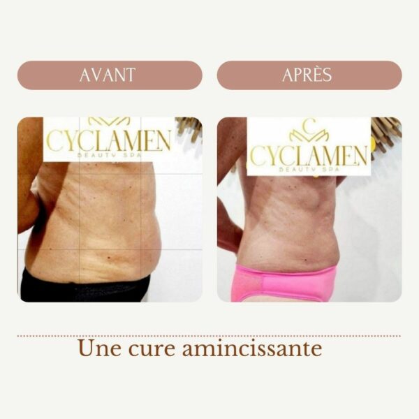 Une cure amincissante